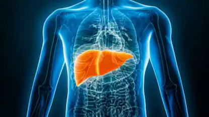 FATTY-LIVER-2026-04-3099cdf66da41fe37edc514879353e30-1200x675